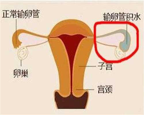 孕妇梦见杀人见血2：北京最大的添悦助孕结构