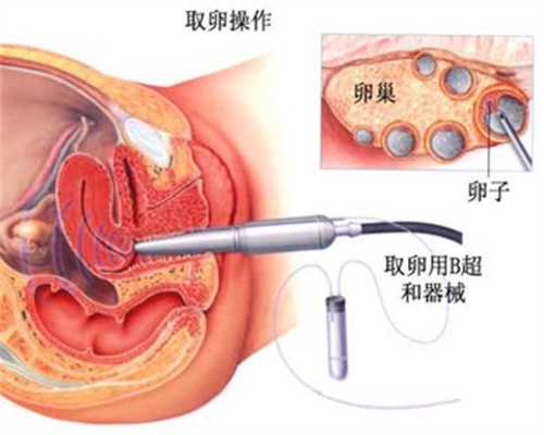 得妊娠湿疹易生儿子吗：上海医院生殖中心添悦助孕